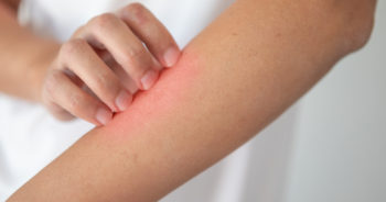 Dlaczego pluskwy są niebezpieczne?